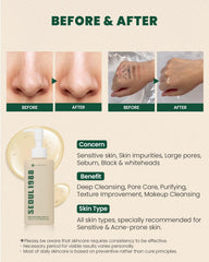 SEOUL 1988 CLEANSING OIL : PINE CICA 1% + PROBIOTICS 200ML