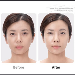 Medicube - AGE-R Booster Pro