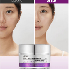 REEDLE SHOT LIFTING CREAM 50ML